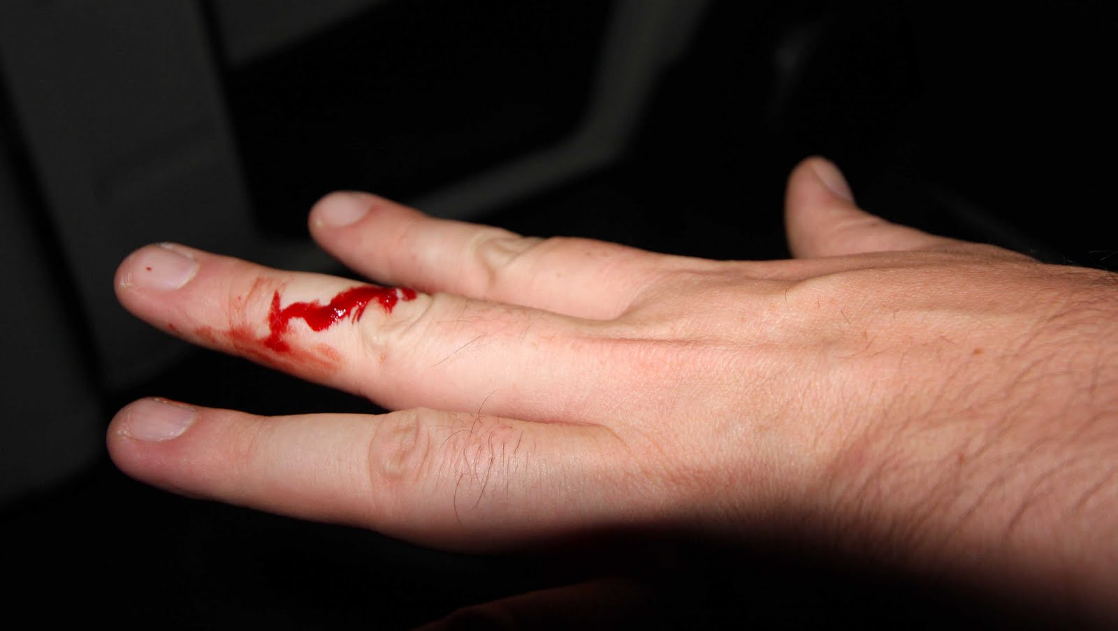 Blutiger Schnitt am Finger
